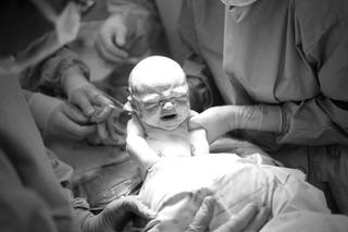 cesarean birth india