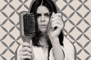 hair loss after pregnancy
