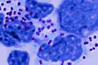 symptoms of gonorrhea