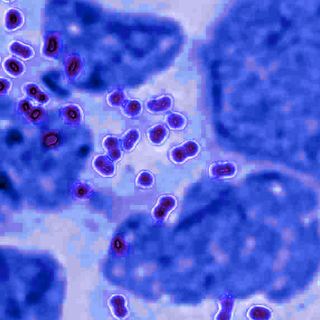 symptoms of gonorrhea