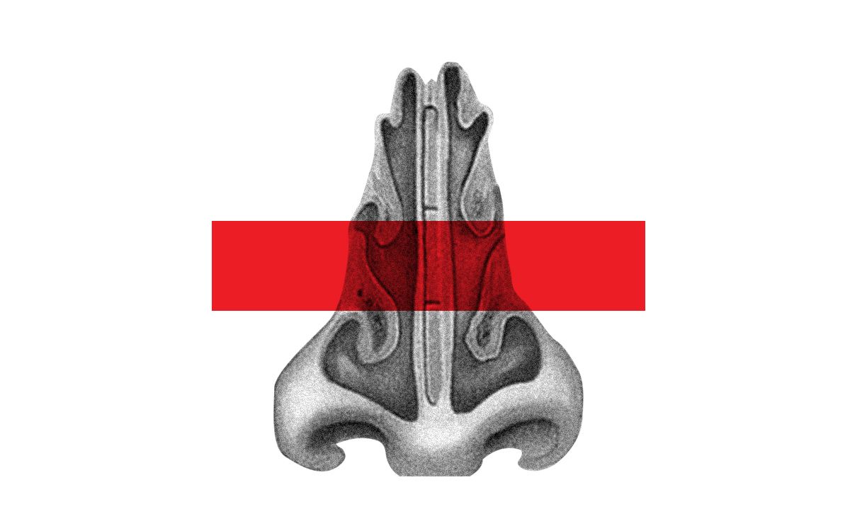 what are the symptoms of a deviated septum
