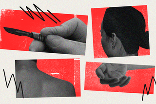 burn victims health resources