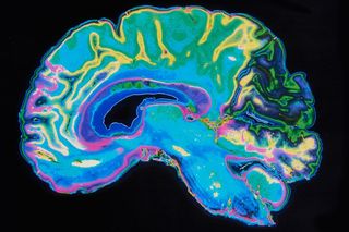 difference between male and female brain