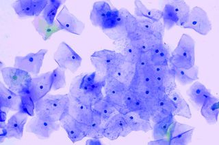 hpv test