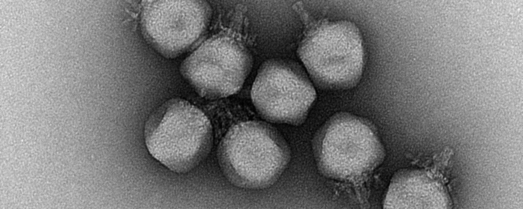 virus gut microbiome