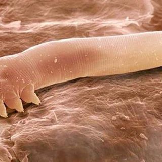 what are face mites