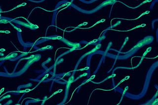 recurrent miscarriage causes