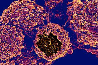 signs and symptoms of chlamydia