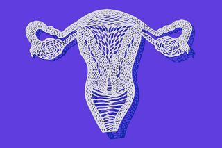 alternative remedies for PCOS