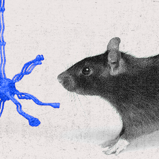 Human neuron transplantation