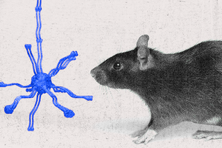 Human neuron transplantation