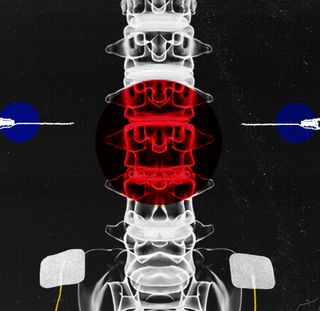 spinal cord injury treatment