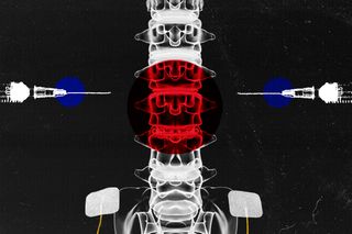 spinal cord injury treatment