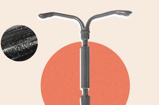 what is an iud