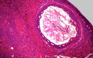 artificial ovary