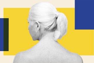what is albinism