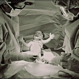 c-section rate in india