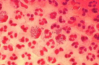 severe PMS symptoms
