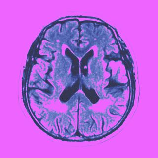covid brain aging