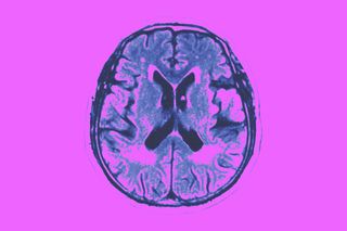 covid brain aging