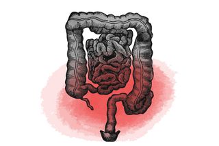 what are ibs symptoms