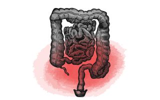 what are ibs symptoms