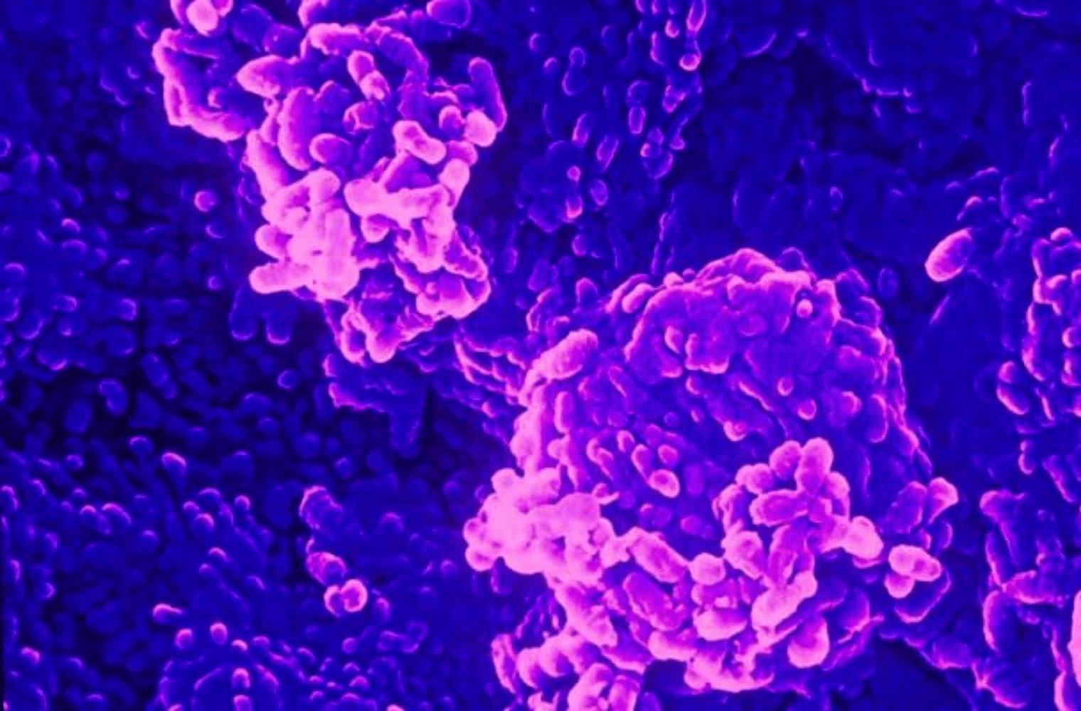 what is bacterial vaginosis