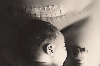 c-section scar