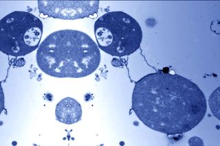 how do bacteria become resistant to antibiotics