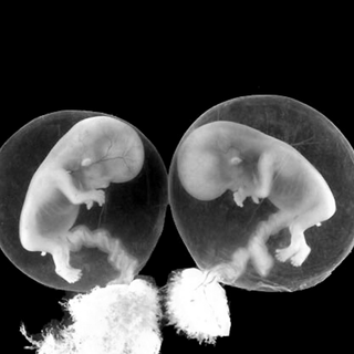 twin birth rates