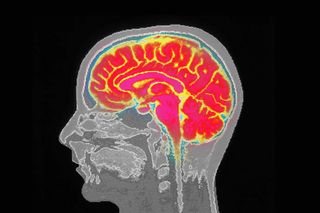 covid19 can change the brain