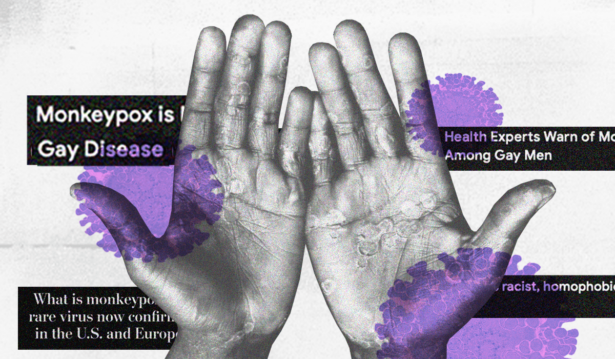 How monkeypox spreads: Experts clear up misinformation