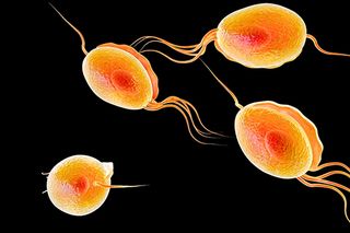 trichomoniasis symptoms