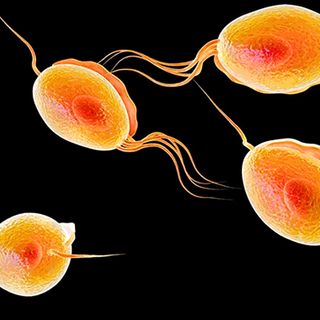 trichomoniasis symptoms