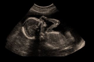 abortion rights in india