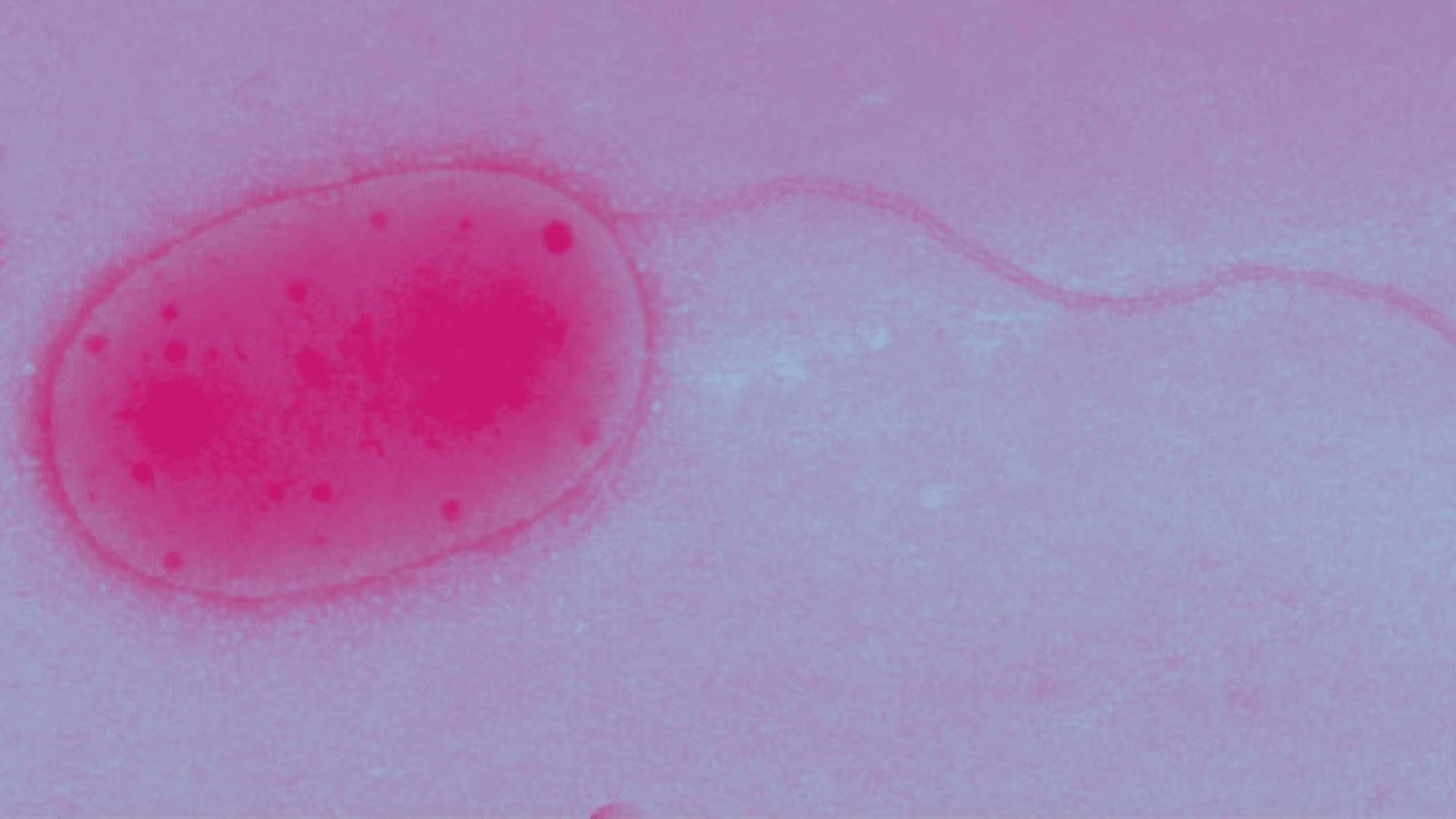 have new microbes been discovered in space