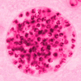 how toxoplasma gondii affects our looks