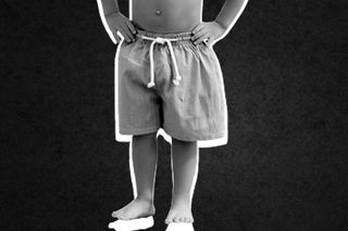 baby undescended testicle surgery