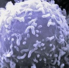 autoimmune disease treatment