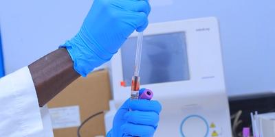 Blood sample testing