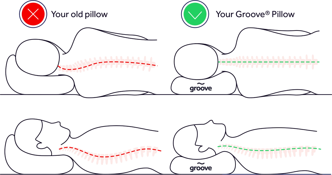 Diagram showing how Groove pillow’s design corrects spine and neck posture