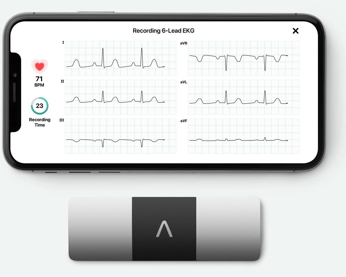 KardiaMobile 6L -laite älypuhelimen kanssa