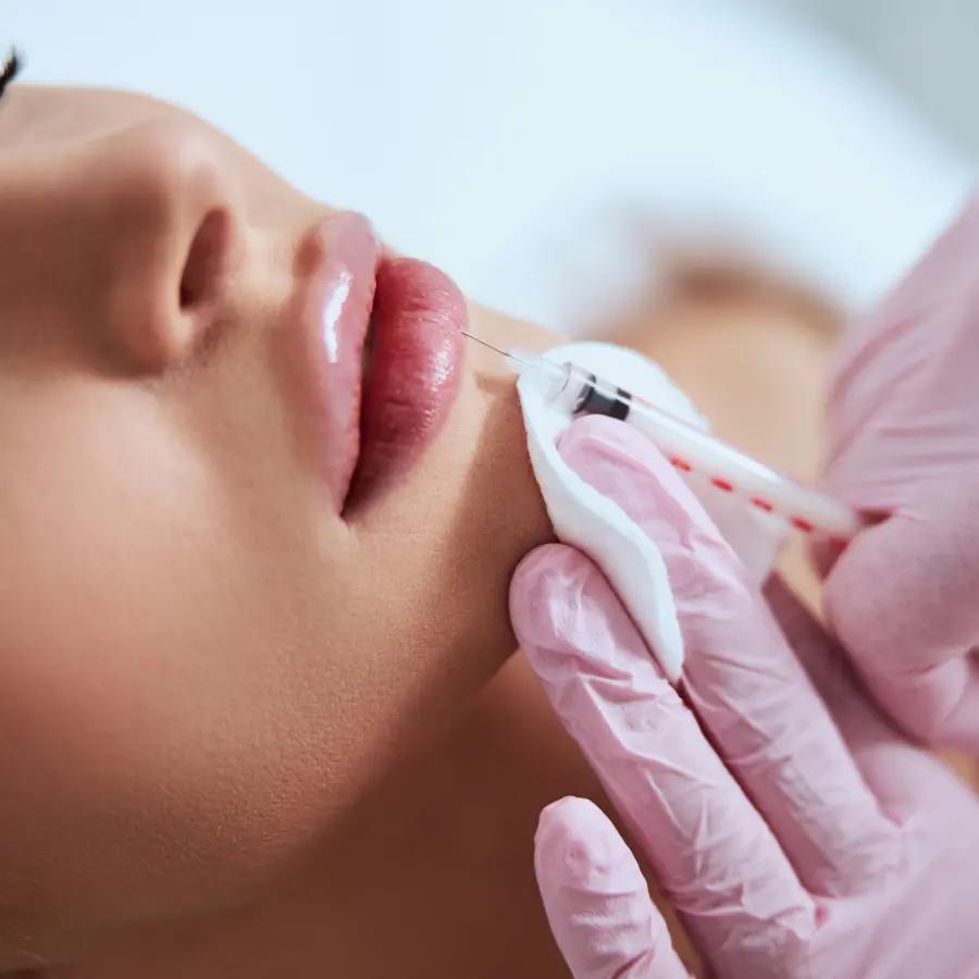 Dermal filler treatment at Blue Medical Spa