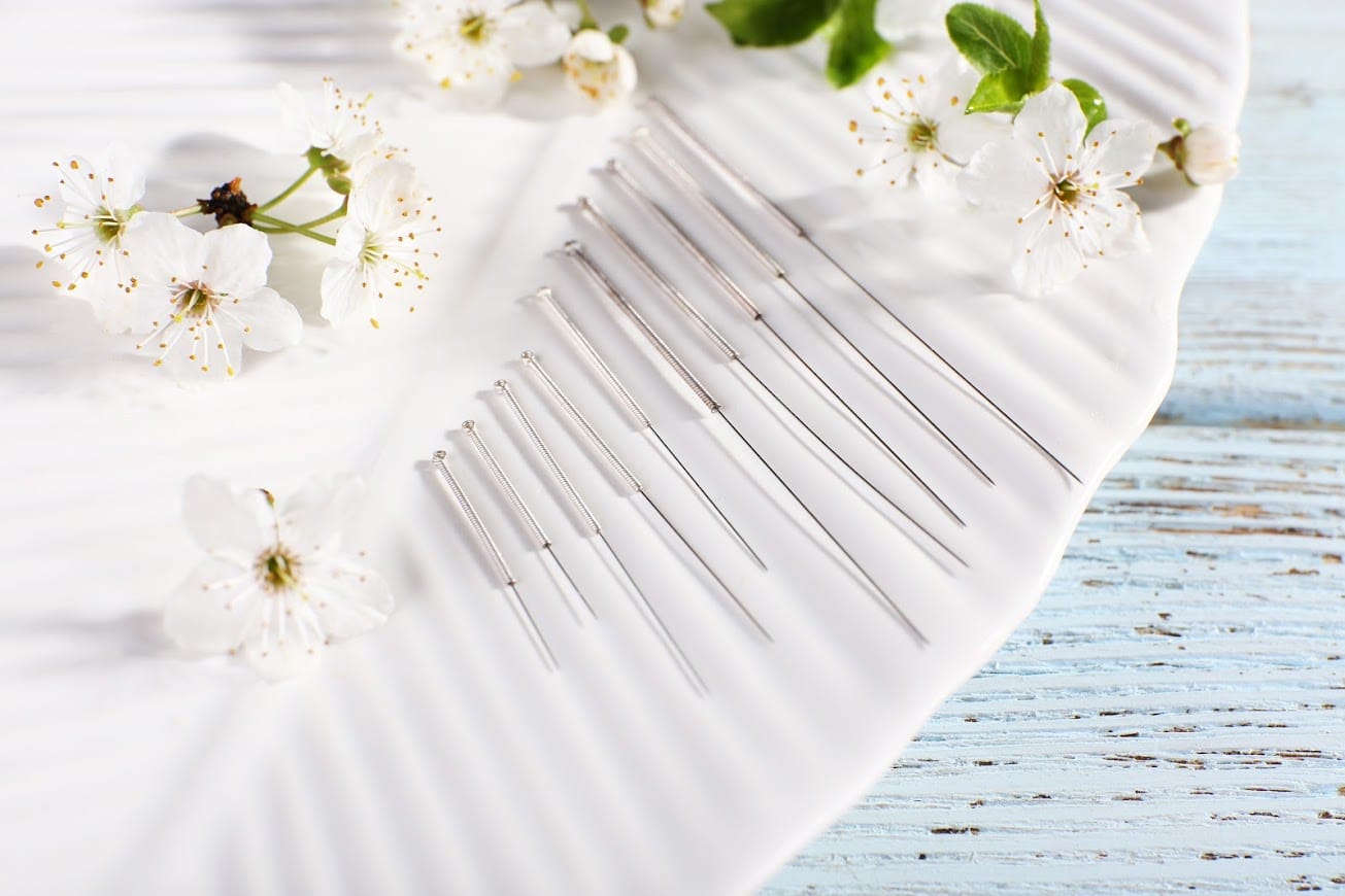 Top 5 Tips to Help You Choose the Best Acupuncturist