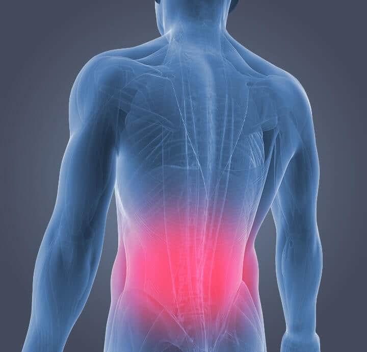 Acupuncture and Back Pain