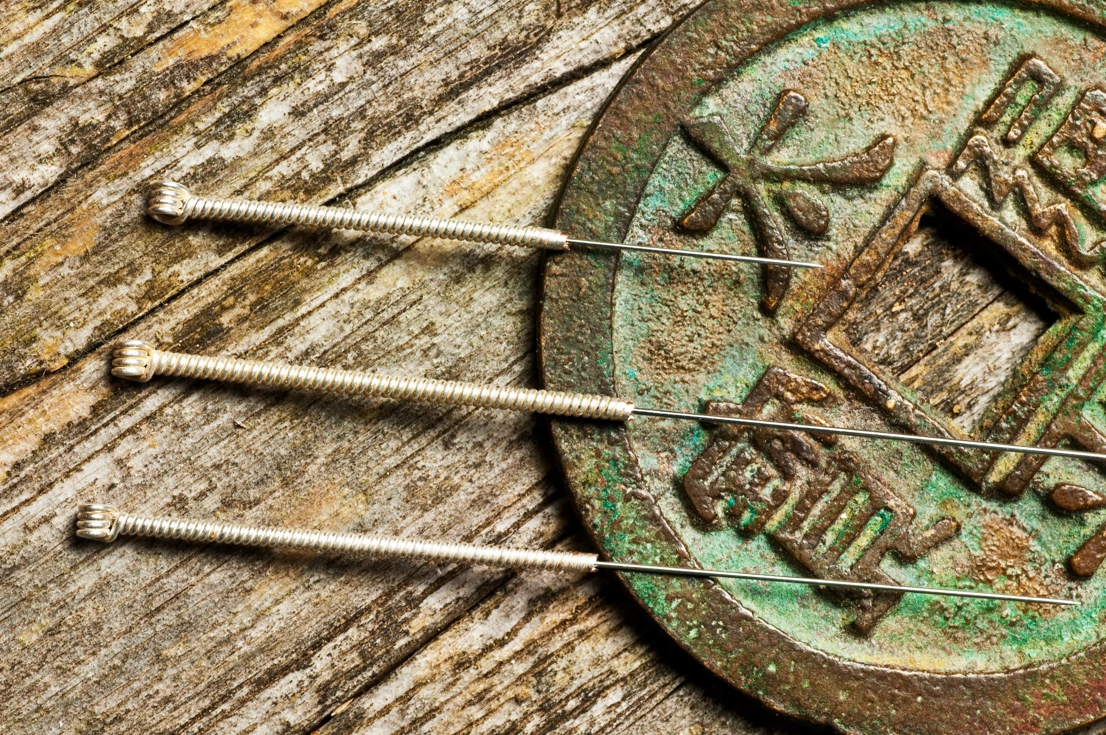 First Time Acupuncture in Milwaukee, Wisconsin? Here’s What to Expect