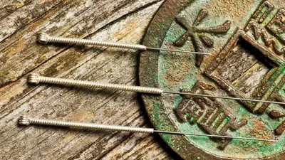 First Time Acupuncture in Milwaukee, Wisconsin? Here’s What to Expect