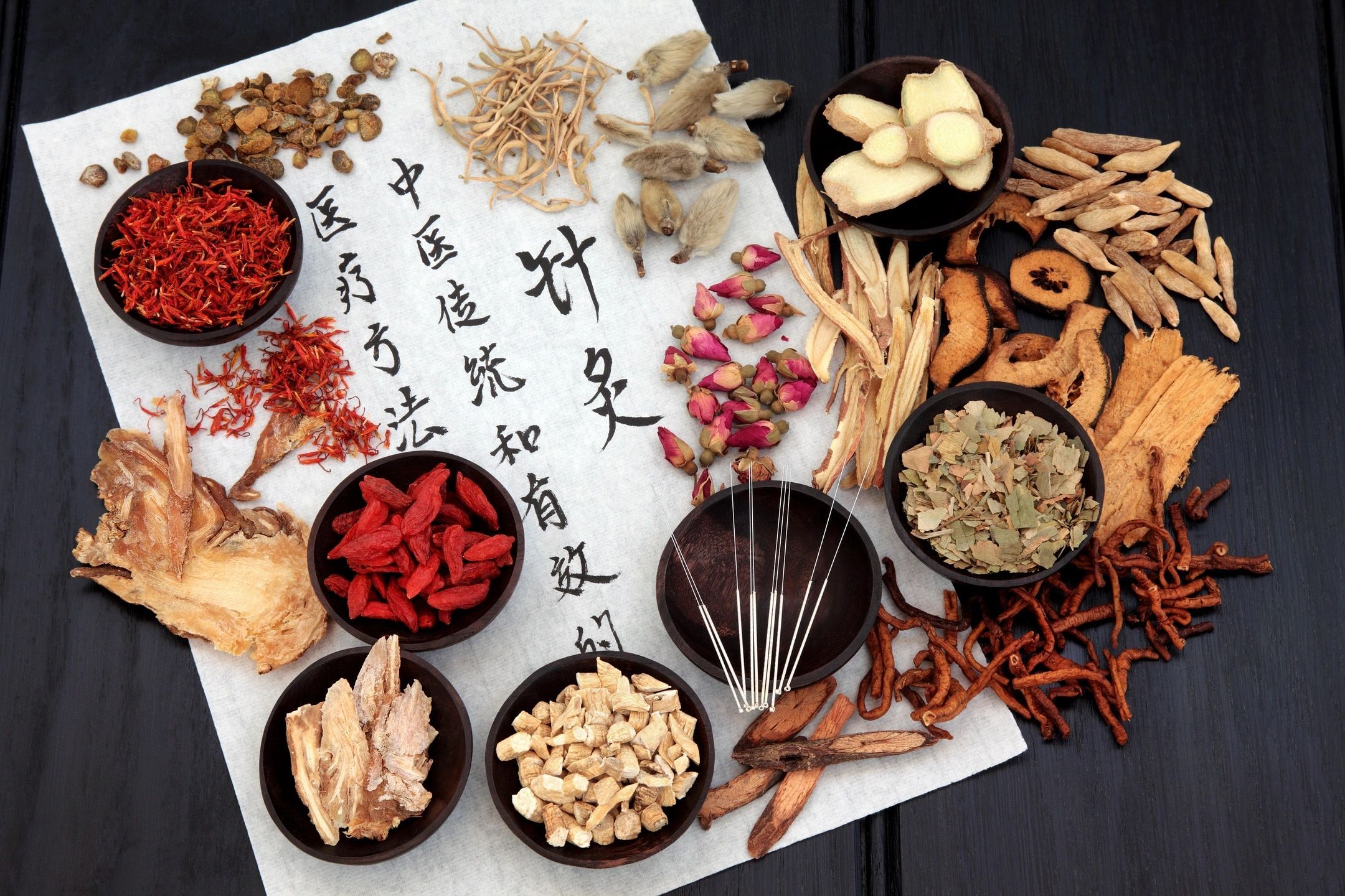 Herbal Remedies and Acupuncture: The Perfect Duo for Healing in Milwaukee, Wisconsin