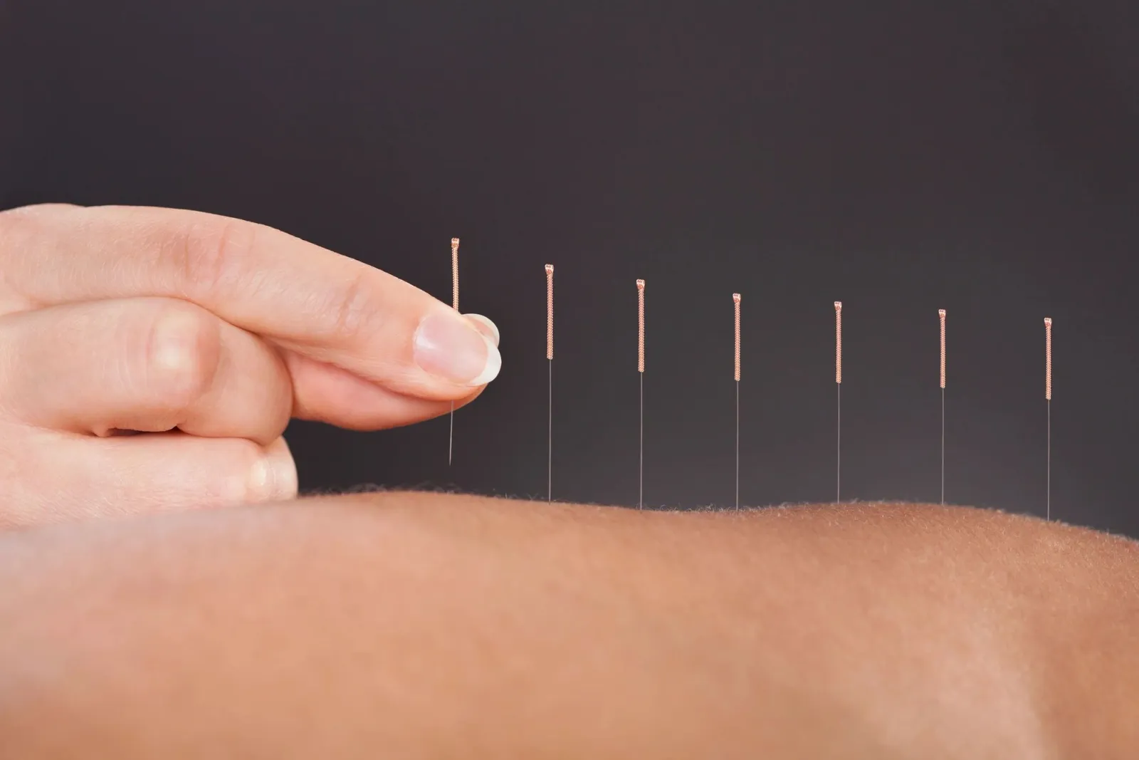 How Does Acupuncture Work? A Beginner’s Guide to Acupuncture in ...
