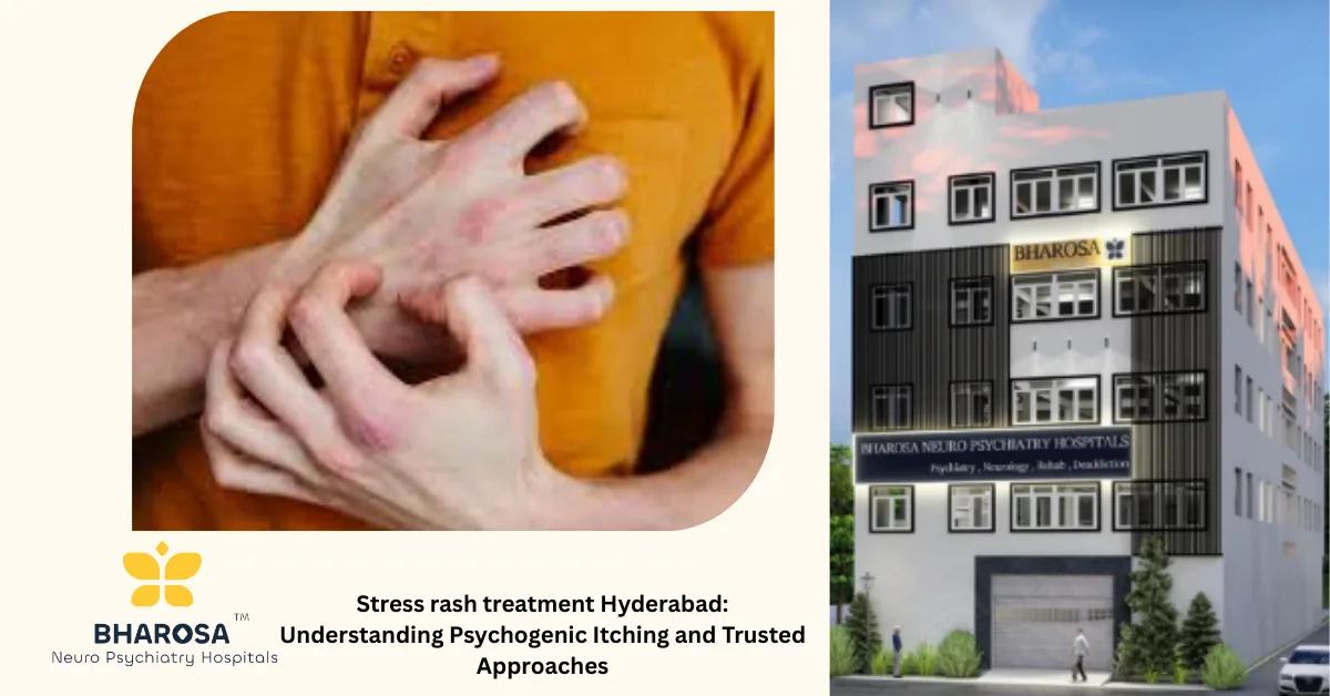 Stress rash treatment Hyderabad: Understanding Psychogenic Itching and Trusted Approaches | Bharosa Hospitals